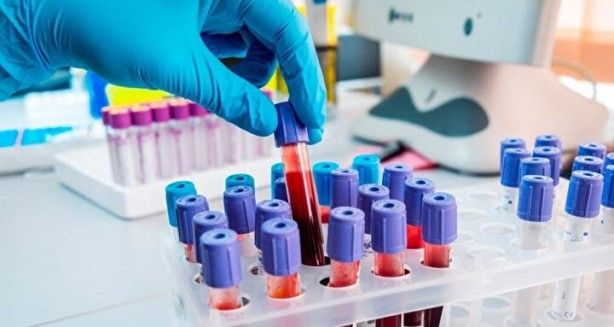 Kimisi olumlu kimisi olumsuz! Kan grubuna göre kişilik modelleri 11