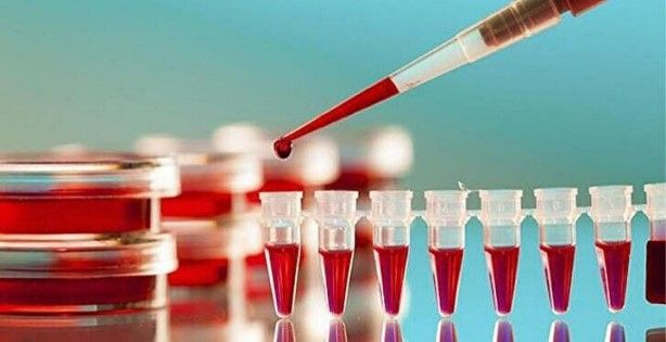 Kimisi olumlu kimisi olumsuz! Kan grubuna göre kişilik modelleri 13