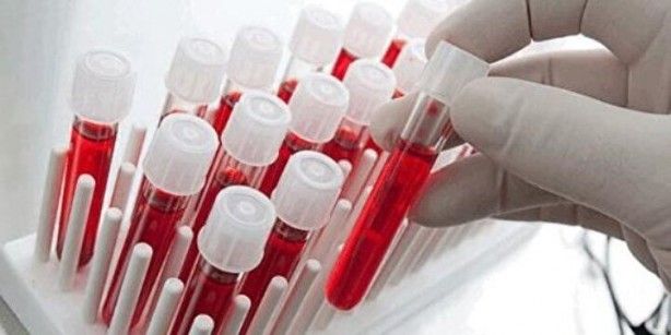 Kimisi olumlu kimisi olumsuz! Kan grubuna göre kişilik modelleri 3