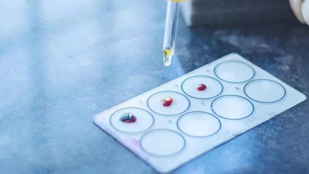 Kimisi olumlu kimisi olumsuz! Kan grubuna göre kişilik modelleri 7