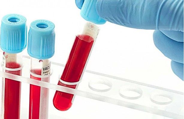 Kimisi olumlu kimisi olumsuz! Kan grubuna göre kişilik modelleri 8