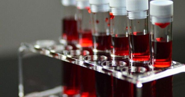 Dünyada sadece 43 kişide var! Gizemli kan grubundan haberiniz var mı? 11