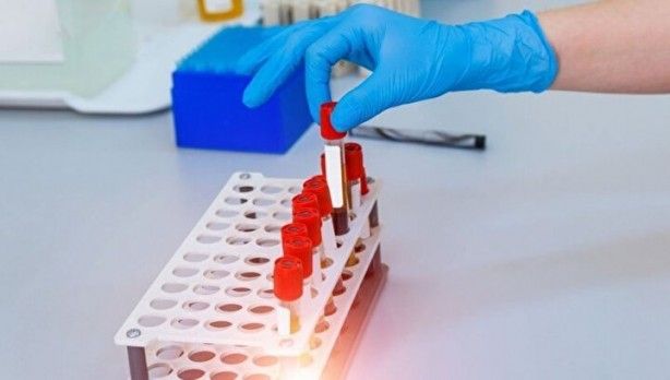 Dünyada sadece 43 kişide var! Gizemli kan grubundan haberiniz var mı? 2