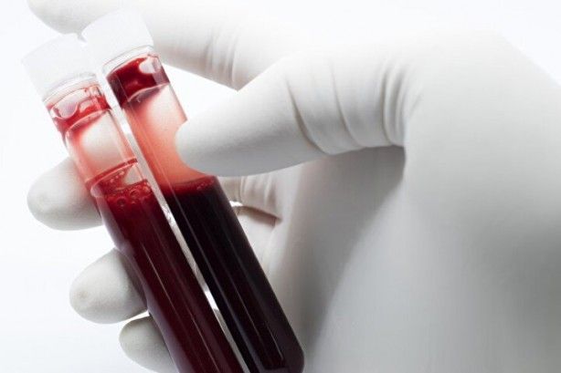 Dünyada sadece 43 kişide var! Gizemli kan grubundan haberiniz var mı? 19