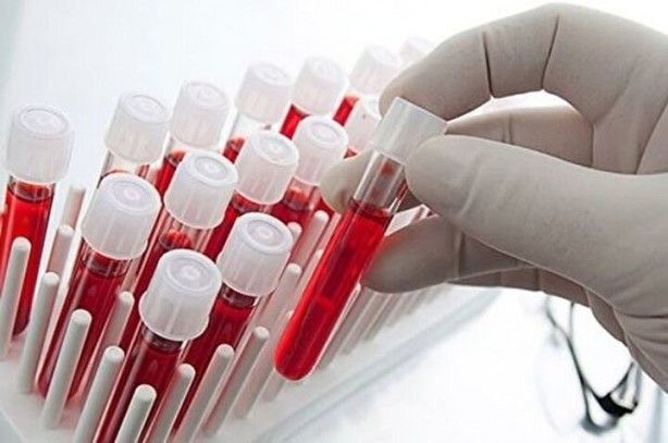 Dünyada sadece 43 kişide var! Gizemli kan grubundan haberiniz var mı? 5
