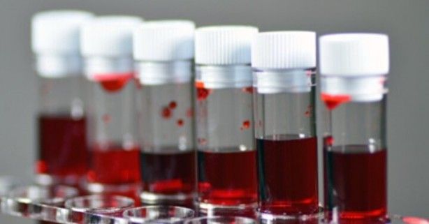 Dünyada sadece 43 kişide var! Gizemli kan grubundan haberiniz var mı? 7