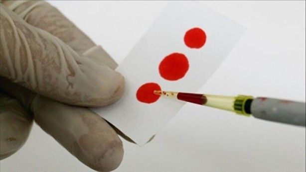 Dünyada sadece 43 kişide var! Gizemli kan grubundan haberiniz var mı? 8