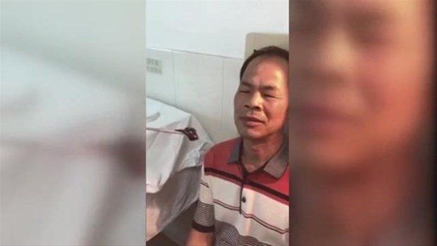 Yer: Zonguldak! 50 yıldır yüzündeydi... Ameliyatla burnundan çıkarılanlar şoke etti 15