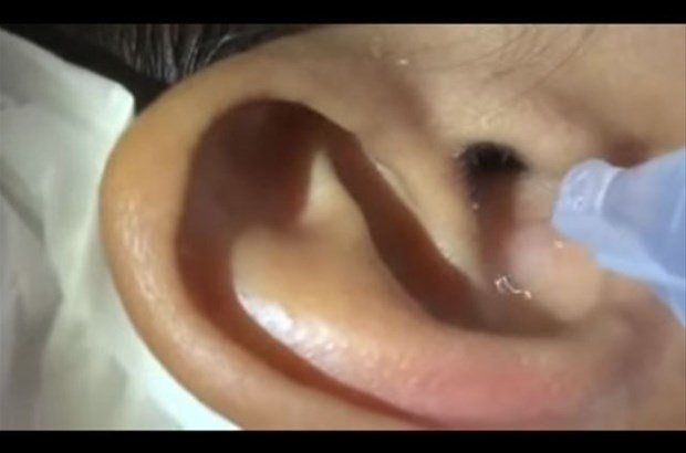 Yer: Zonguldak! 50 yıldır yüzündeydi... Ameliyatla burnundan çıkarılanlar şoke etti 19