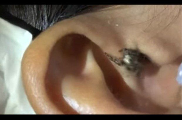 Yer: Zonguldak! 50 yıldır yüzündeydi... Ameliyatla burnundan çıkarılanlar şoke etti 21