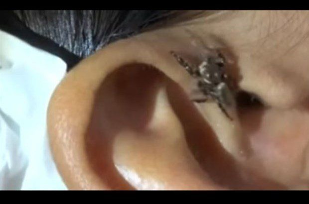 Yer: Zonguldak! 50 yıldır yüzündeydi... Ameliyatla burnundan çıkarılanlar şoke etti 23