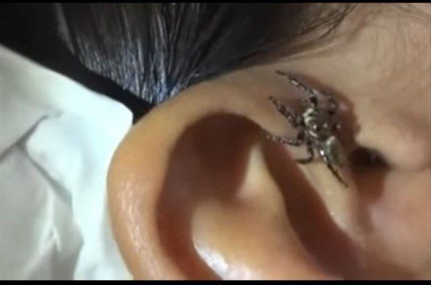 Yer: Zonguldak! 50 yıldır yüzündeydi... Ameliyatla burnundan çıkarılanlar şoke etti 24