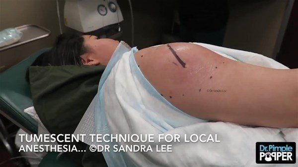 Yer: Zonguldak! 50 yıldır yüzündeydi... Ameliyatla burnundan çıkarılanlar şoke etti 27