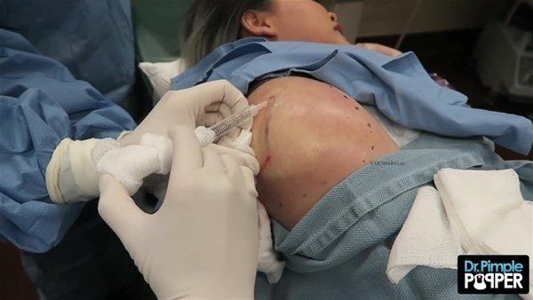 Yer: Zonguldak! 50 yıldır yüzündeydi... Ameliyatla burnundan çıkarılanlar şoke etti 32