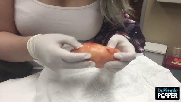 Yer: Zonguldak! 50 yıldır yüzündeydi... Ameliyatla burnundan çıkarılanlar şoke etti 66