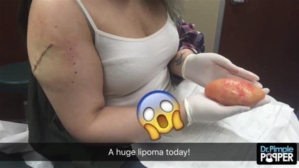 Yer: Zonguldak! 50 yıldır yüzündeydi... Ameliyatla burnundan çıkarılanlar şoke etti 67