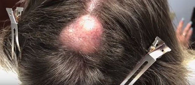 Yer: Zonguldak! 50 yıldır yüzündeydi... Ameliyatla burnundan çıkarılanlar şoke etti 68