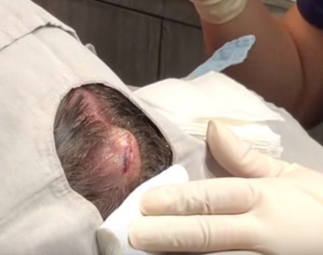 Yer: Zonguldak! 50 yıldır yüzündeydi... Ameliyatla burnundan çıkarılanlar şoke etti 74