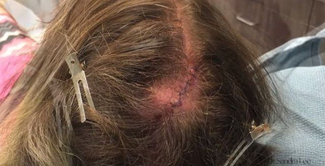 Yer: Zonguldak! 50 yıldır yüzündeydi... Ameliyatla burnundan çıkarılanlar şoke etti 81