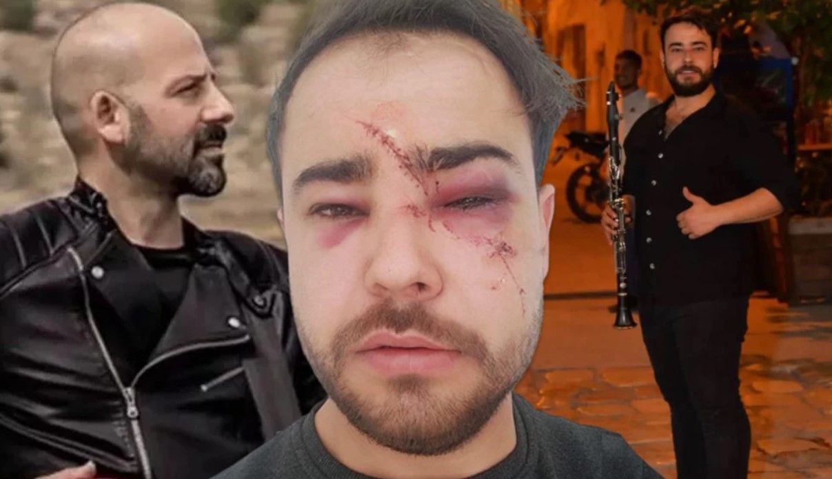 Bir Onur Şener vakası daha! Yusufcan Karagündüz’ü istek parça yüzünden öldüresiye dövdüler 1