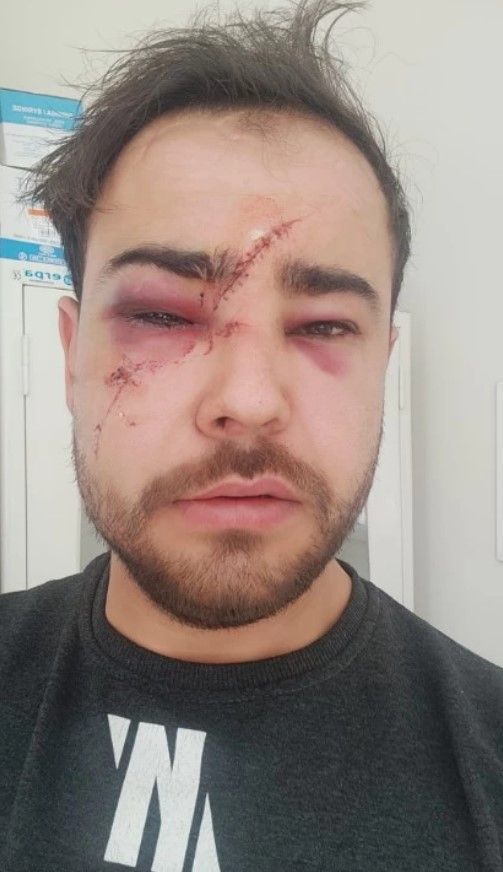 Bir Onur Şener vakası daha! Yusufcan Karagündüz’ü istek parça yüzünden öldüresiye dövdüler 3