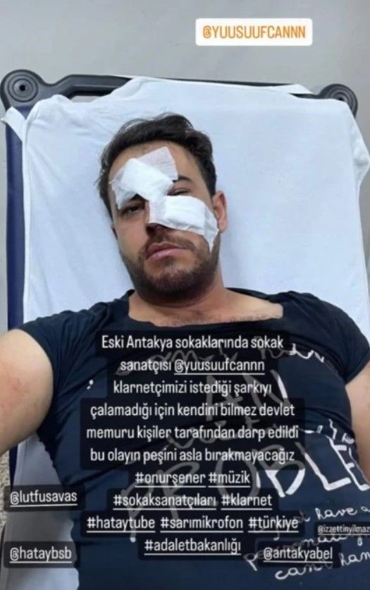 Bir Onur Şener vakası daha! Yusufcan Karagündüz’ü istek parça yüzünden öldüresiye dövdüler 4