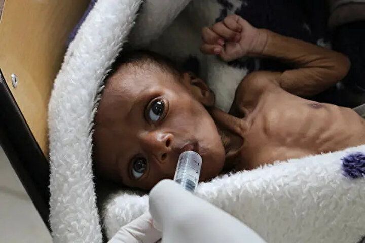 O ülkede tüm şuruplar yasaklandı: 99 çocuğun ölümüne sebep olmuştu 8