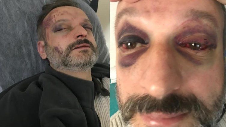 Bu insanlar çıldırmış olmalı: İstek şarkı cinneti devam ediyor! Bir Onur Şener vakası daha... 1