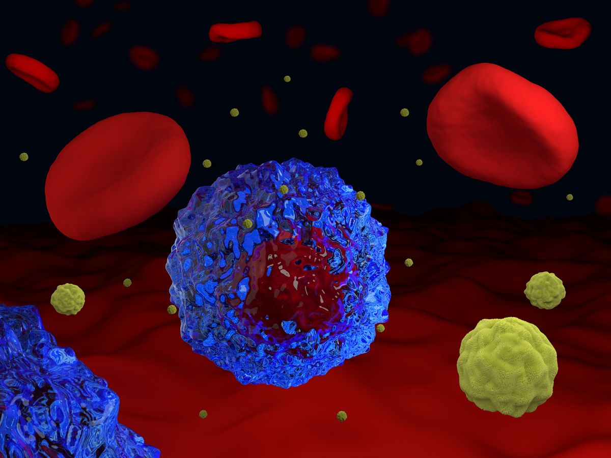 Türkiye’de 4 kadından birinde görülüyor! Dünyada ilk on kanser arasında yer alıyor 2