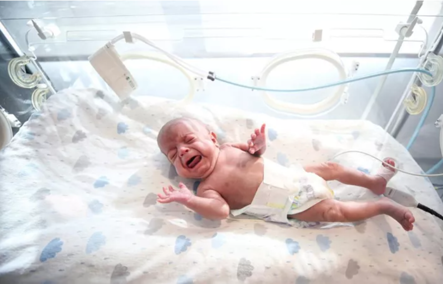 Yaşam şansı yüzde 1`in bile altındaydı: 600 gramlık 'parmak bebekten sevindirici haber 2
