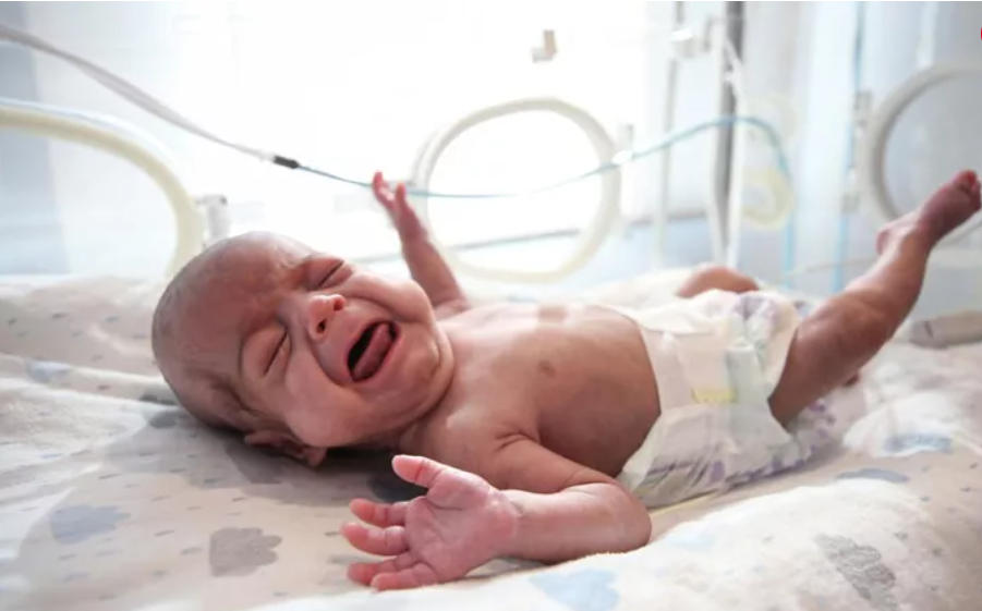 Yaşam şansı yüzde 1`in bile altındaydı: 600 gramlık 'parmak bebekten sevindirici haber 3