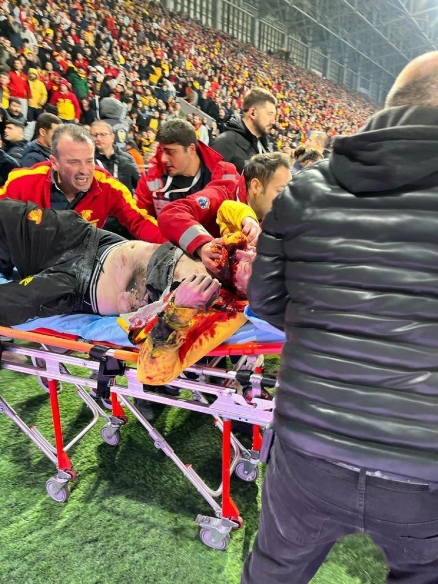 İşte 3 kişinin yaralandığı fişekleri stada sokan sözde sağlıkçılar! 3