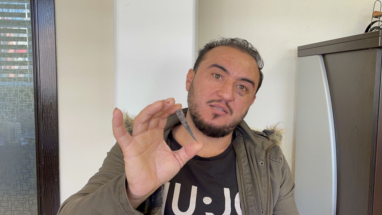 2 aydır haberi bile yoktu! Röntgen çekilince hayatının şokunu yaşadı 1