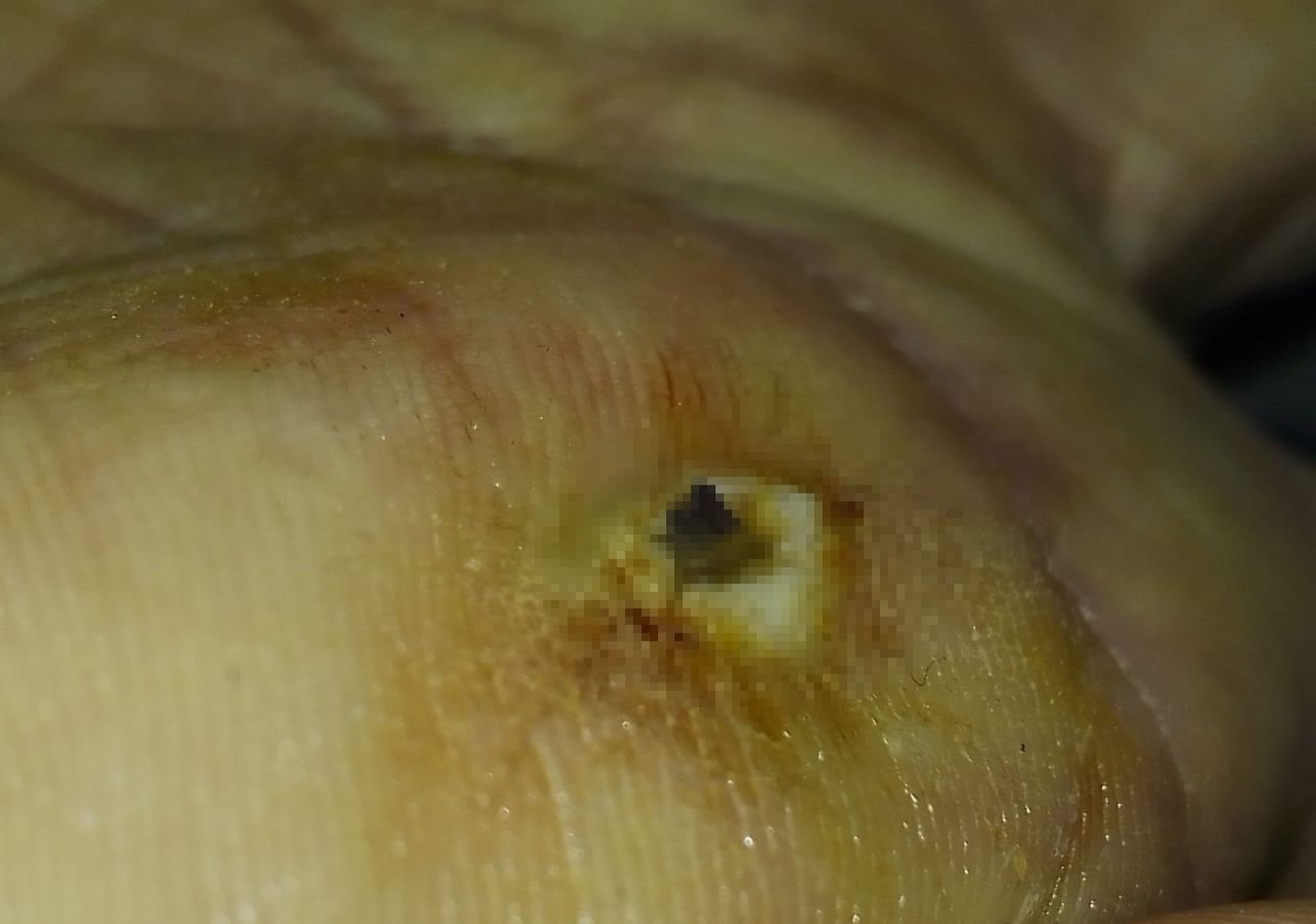 2 aydır haberi bile yoktu! Röntgen çekilince hayatının şokunu yaşadı 3