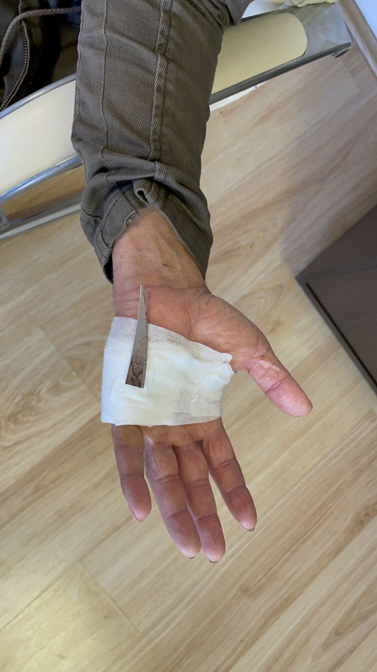 2 aydır haberi bile yoktu! Röntgen çekilince hayatının şokunu yaşadı 5