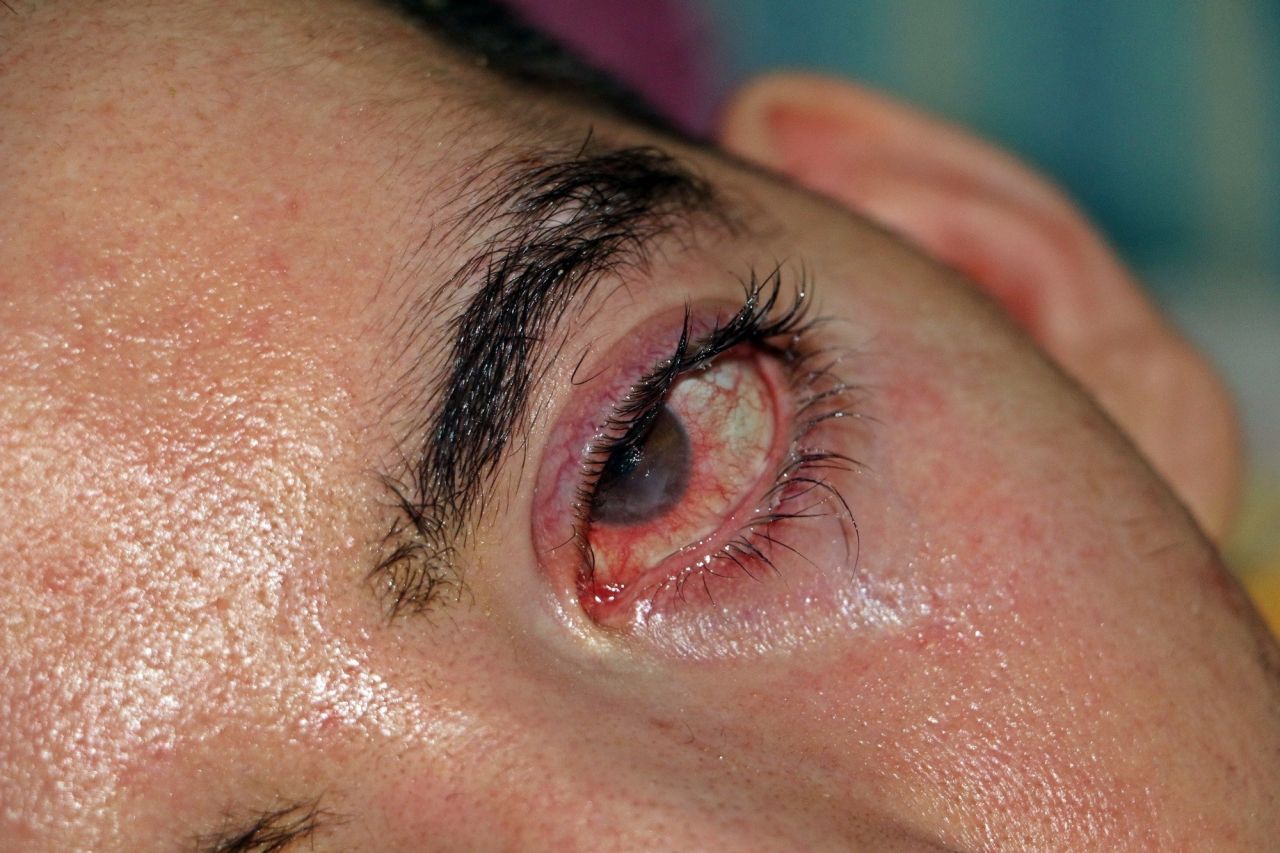 10 yıldır gözlerini bir kez bile kırpamadı! Görenlerin içi acıyor 2