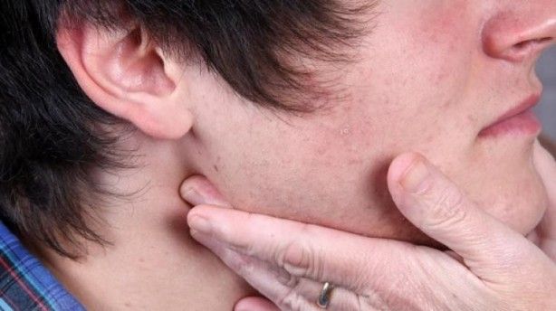 Ağız içinde çıkan yaralara dikkat! Kanser tehlikesiyle karşı karşıya olabilirsiniz 7