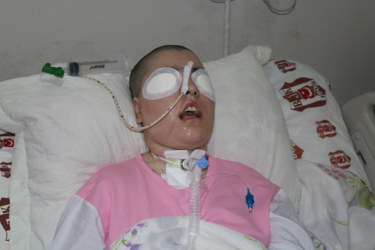 '1 seneden fazla yaşamaz' denildi, Zilan Ataş 12 yıldır yaşam mücadelesi veriyor 3