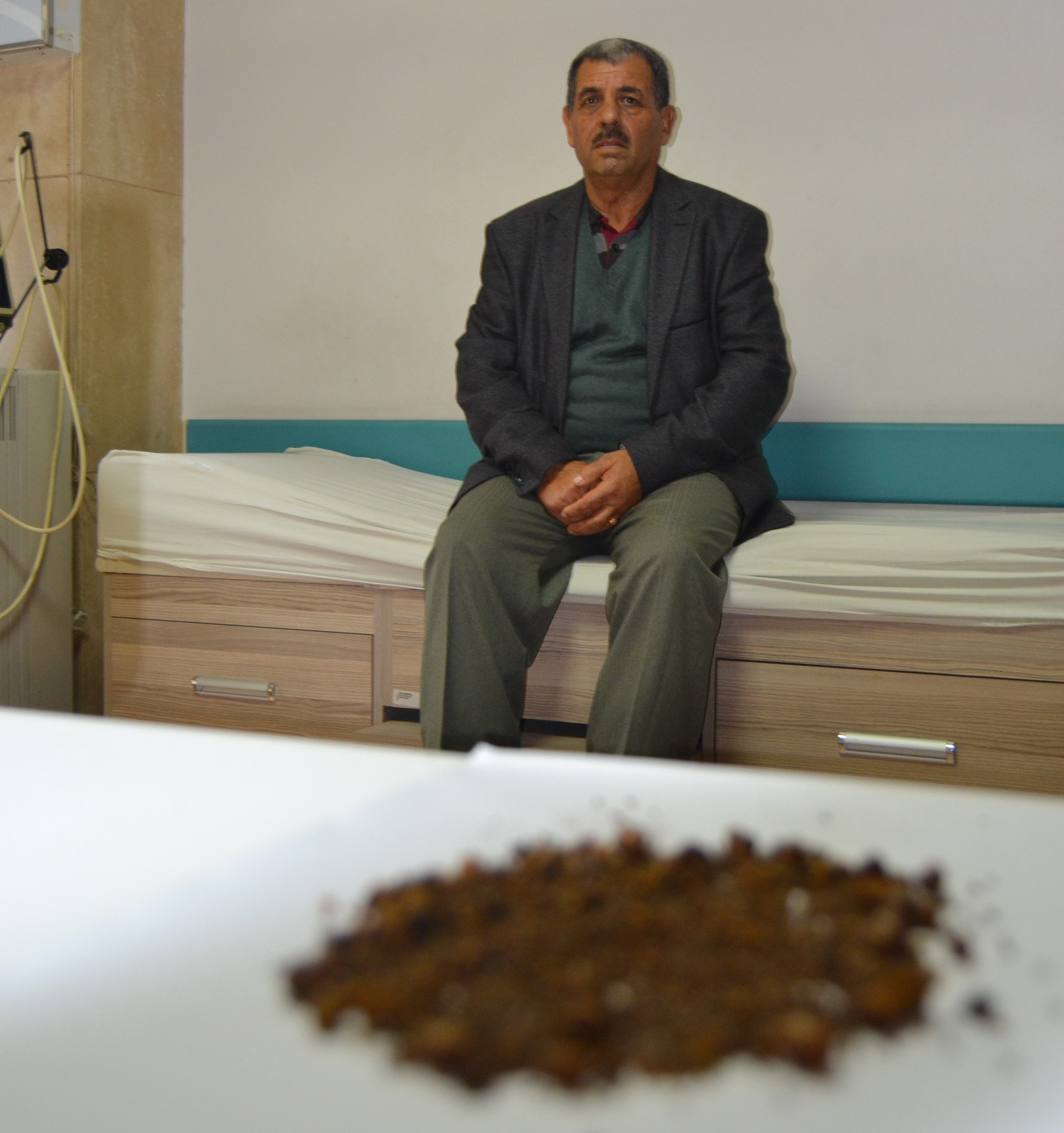 Şiddetli karın ağrısı şikayetiyle gitti! 4 bin 536 tane çıkarıldı 1