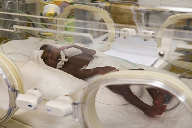 Dünyanın tek dokuzları: Herkes bebekleri görmek için akın ediyor 2