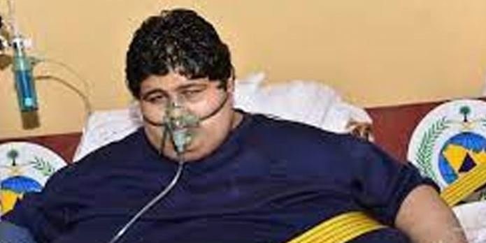 Vinçle evden çıkarılmıştı, tam 542 kilo verdi! Son halini görenler inanamıyor 4