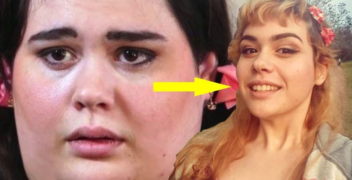 Doktor genç yaşta ölürsün dedi, tam 200 kilo verdi! Son halini görenler şaşkına dönüyor 14