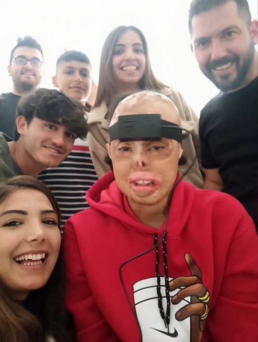 Türkiye’de bir ilk! Bu gözlüğün özelliğini duyanlar şaşırıyor 2