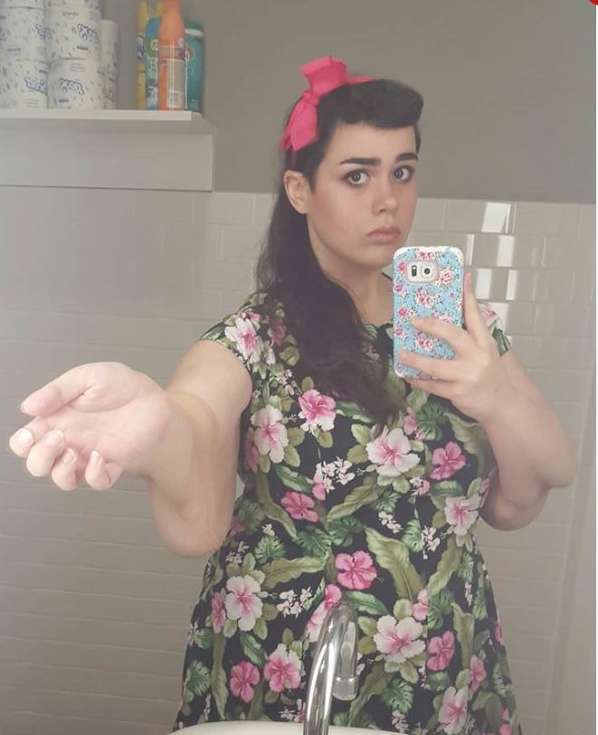 Doktor genç yaşta ölürsün dedi, tam 200 kilo verdi! Son halini görenler şaşkına dönüyor 10