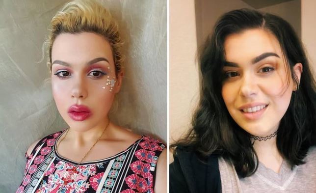 Doktor genç yaşta ölürsün dedi, tam 200 kilo verdi! Son halini görenler şaşkına dönüyor 6