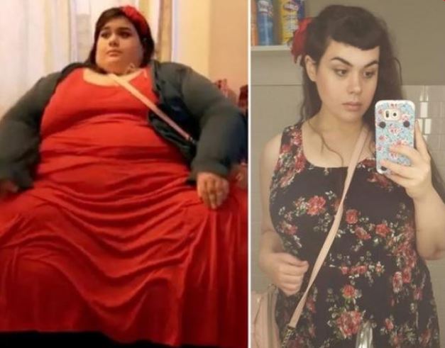 Doktor genç yaşta ölürsün dedi, tam 200 kilo verdi! Son halini görenler şaşkına dönüyor 5