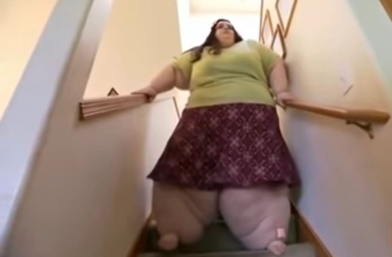 Doktor genç yaşta ölürsün dedi, tam 200 kilo verdi! Son halini görenler şaşkına dönüyor 3