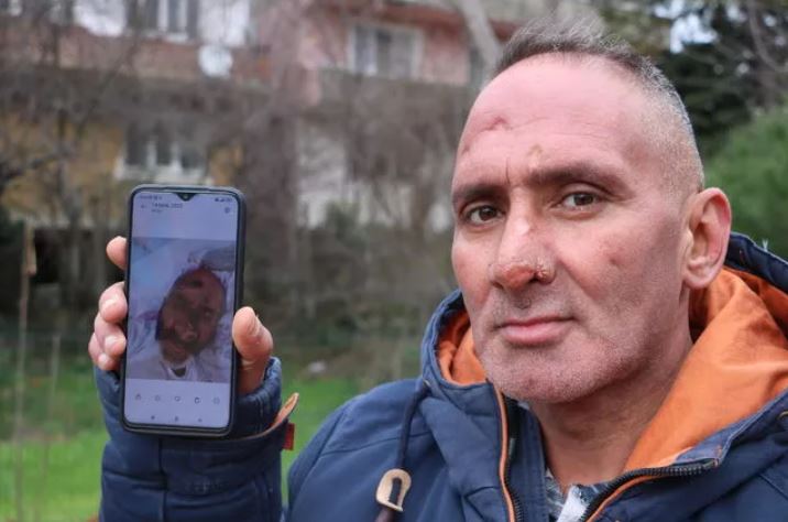 Çalışmak için Antalya'ya gitti hayatı karardı! Her şey bir ısırıkla oldu 5