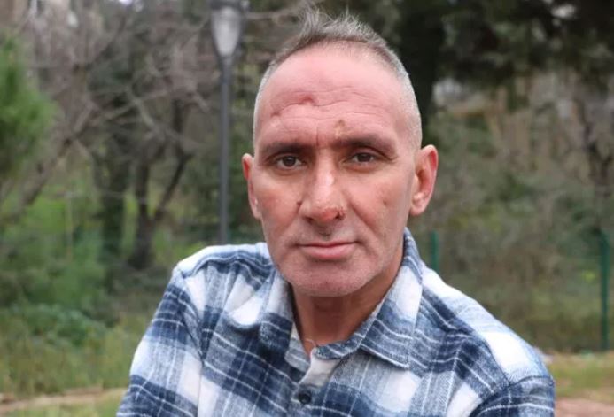 Çalışmak için Antalya'ya gitti hayatı karardı! Her şey bir ısırıkla oldu 4