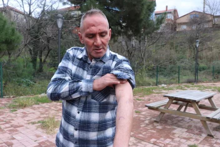 Çalışmak için Antalya'ya gitti hayatı karardı! Her şey bir ısırıkla oldu 1